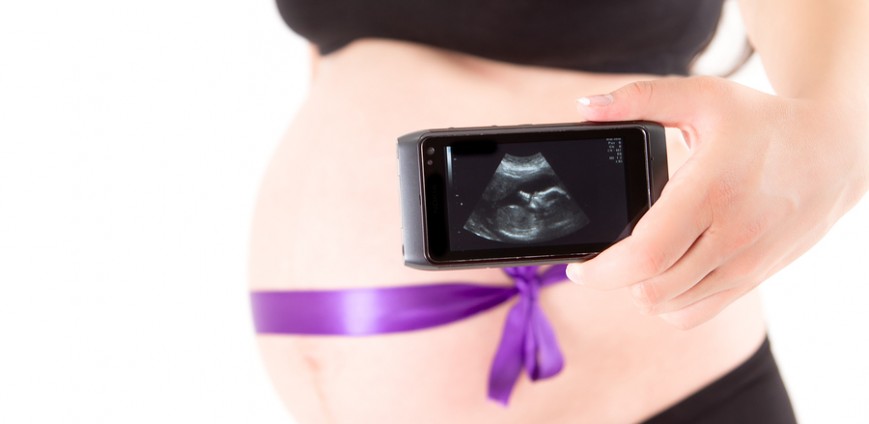 Baby Ultrasound Scans – FAQ