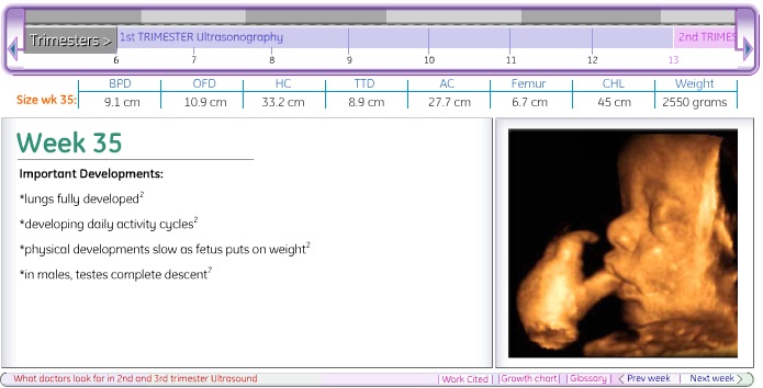 images of babies development at different stages